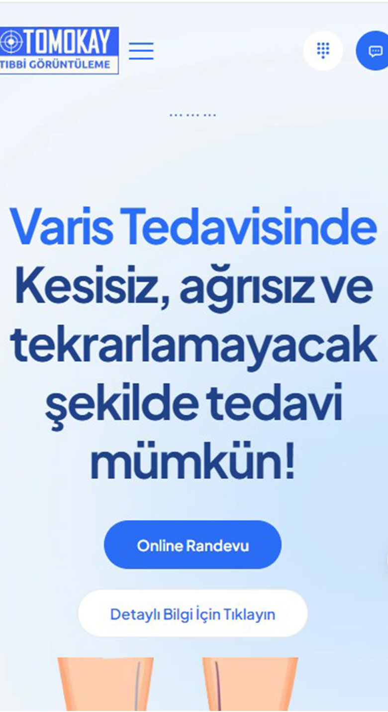 varis-tedavisi-bursa